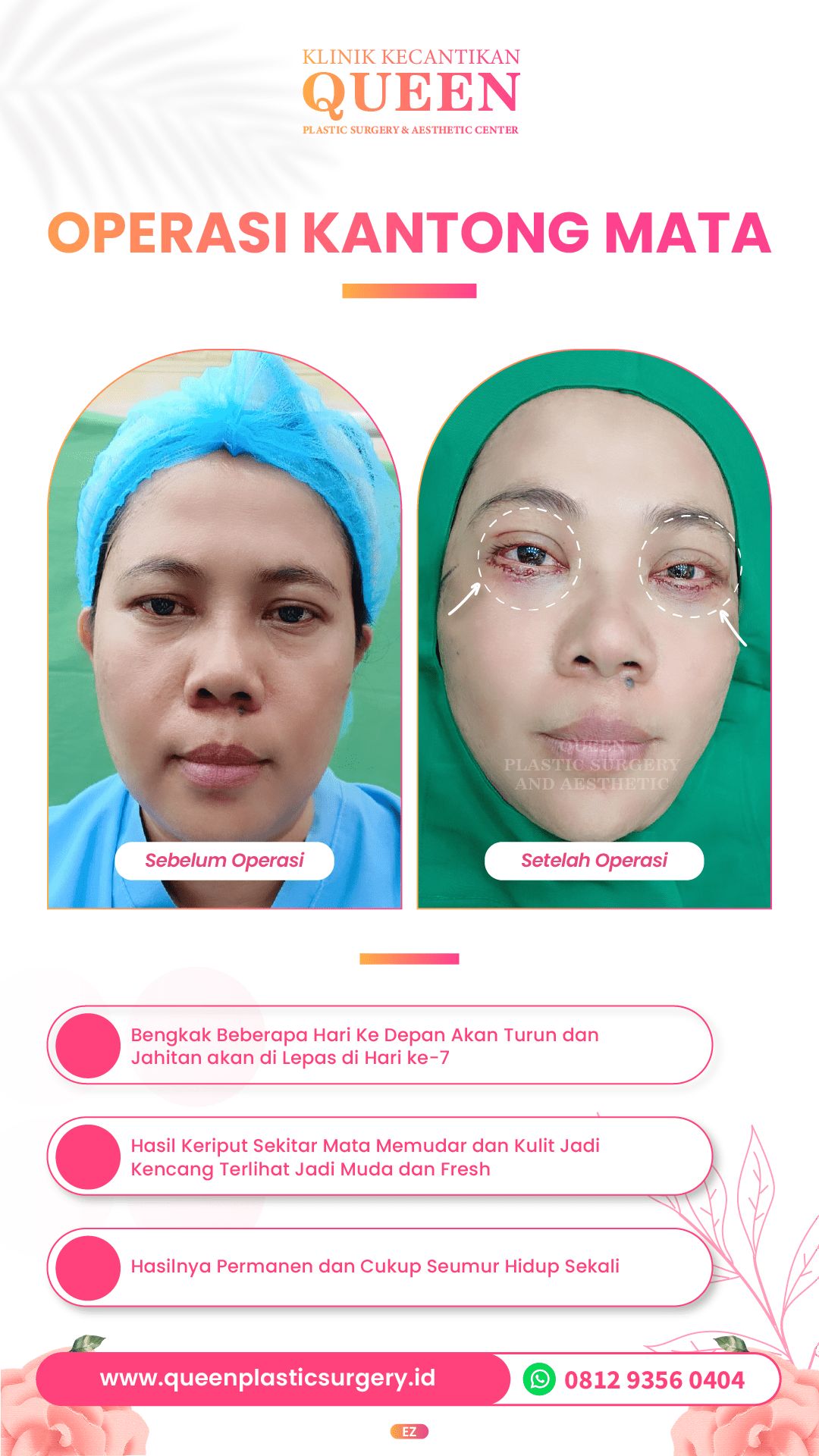 Design Queen 1-06-fotor-20240401161041