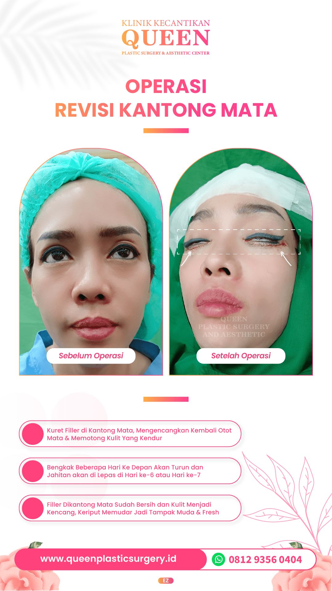 Design Queen 1-09-fotor-2024040116136