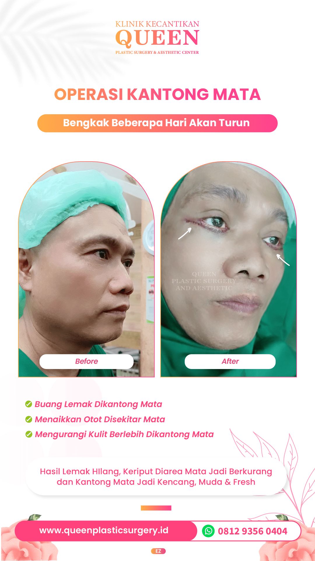 Design Queen 13-02-fotor-2024040116832