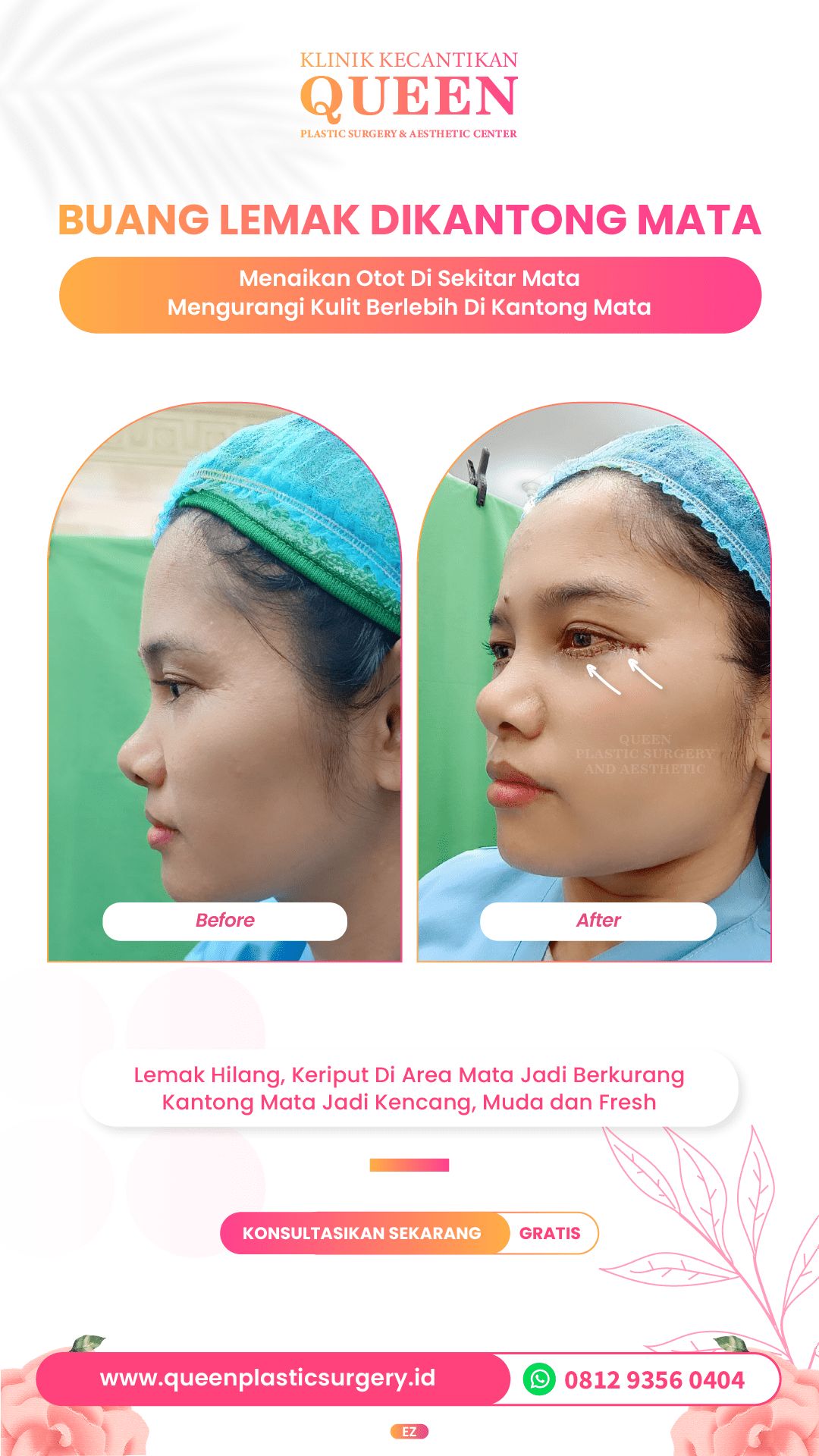 Design Queen 15-04-fotor-2024040116129