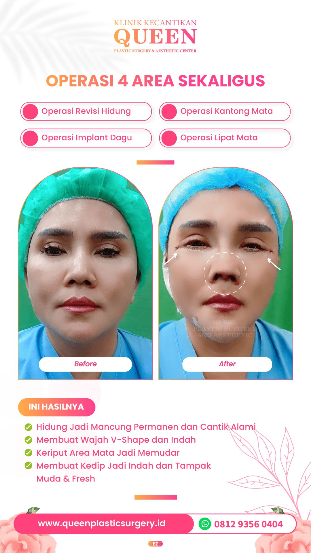 Design Queen 3-06-fotor-2024040116848 (2)