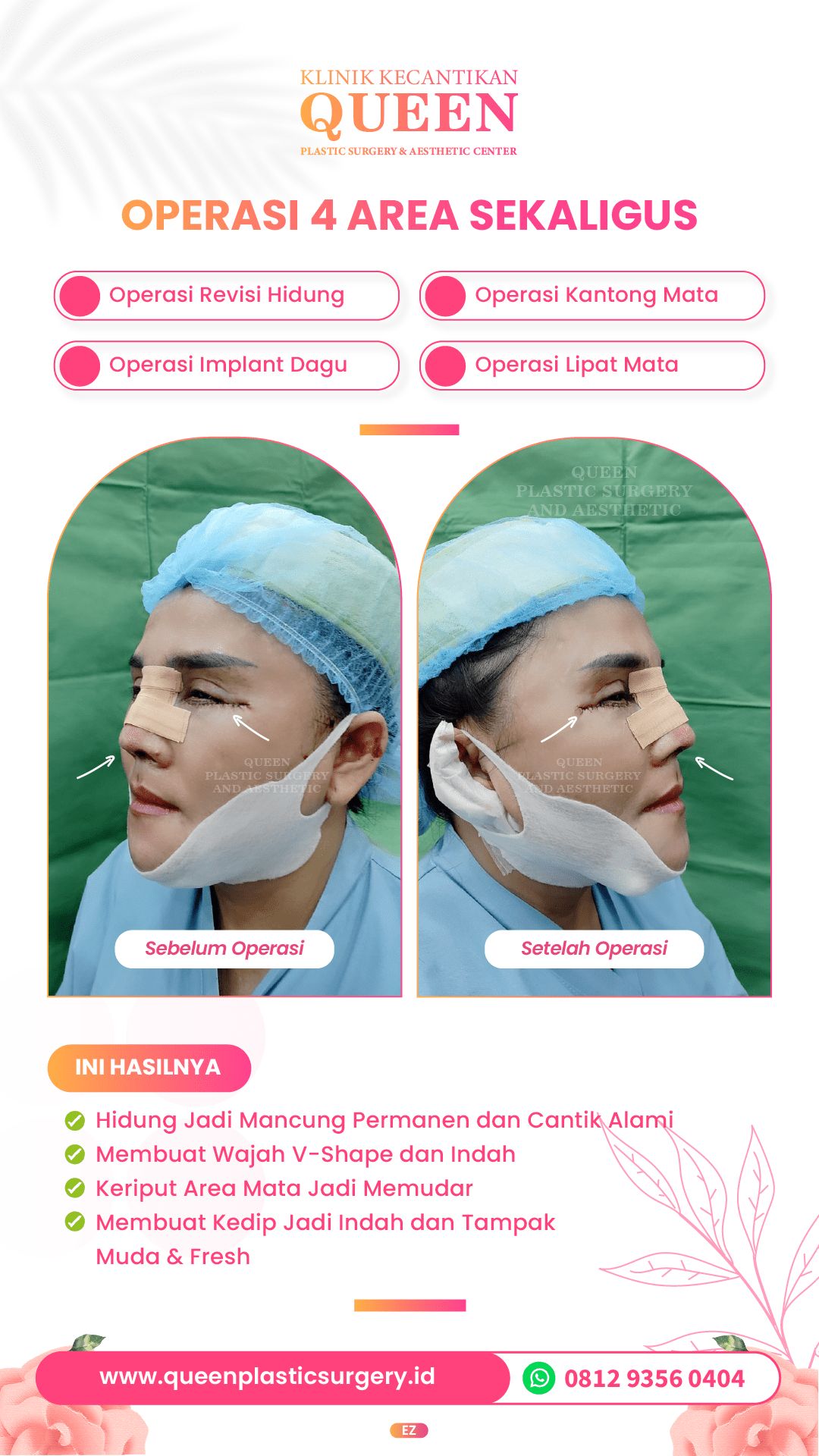 Design Queen 3-09-fotor-202404011696