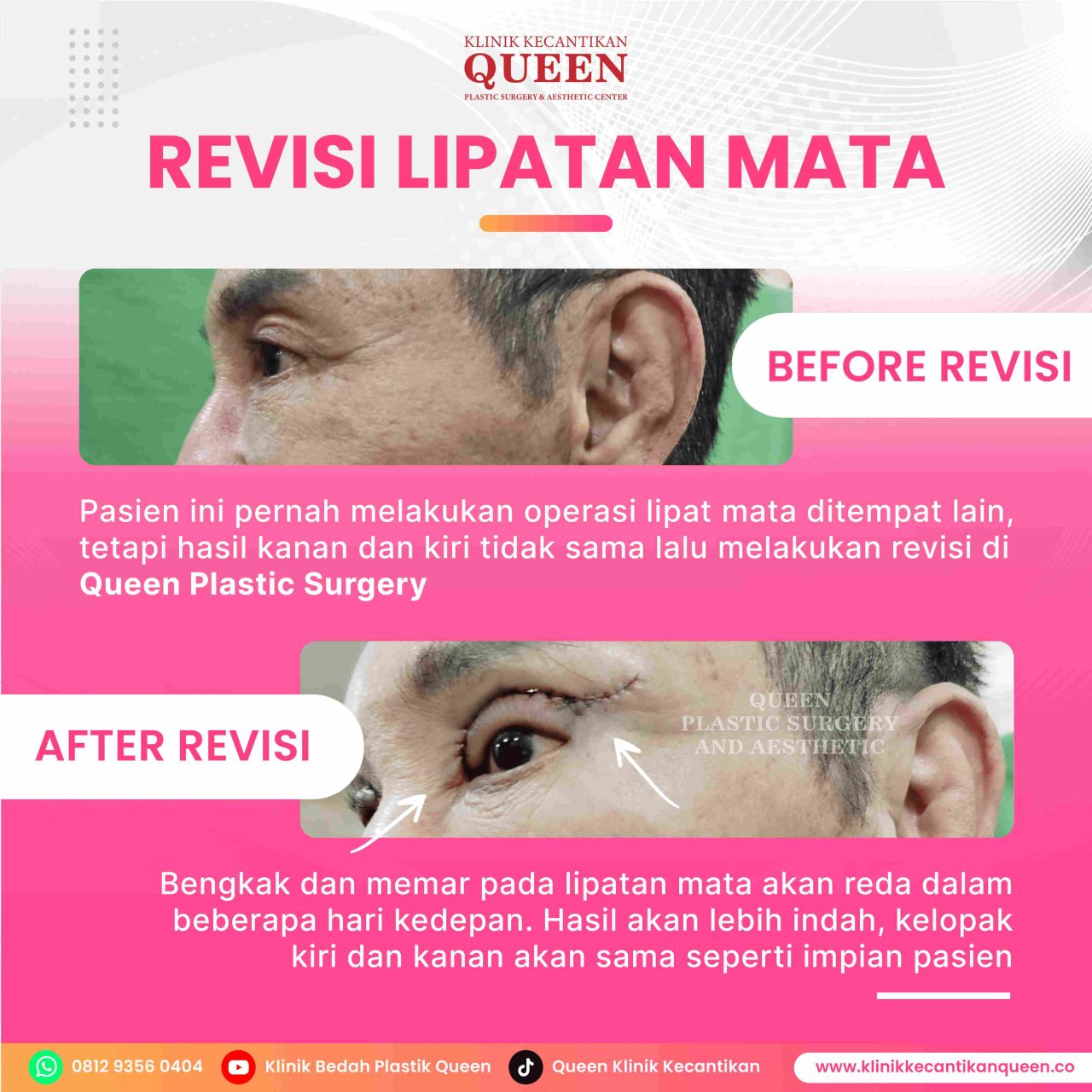 Feed10-01-fotor-2024062819155