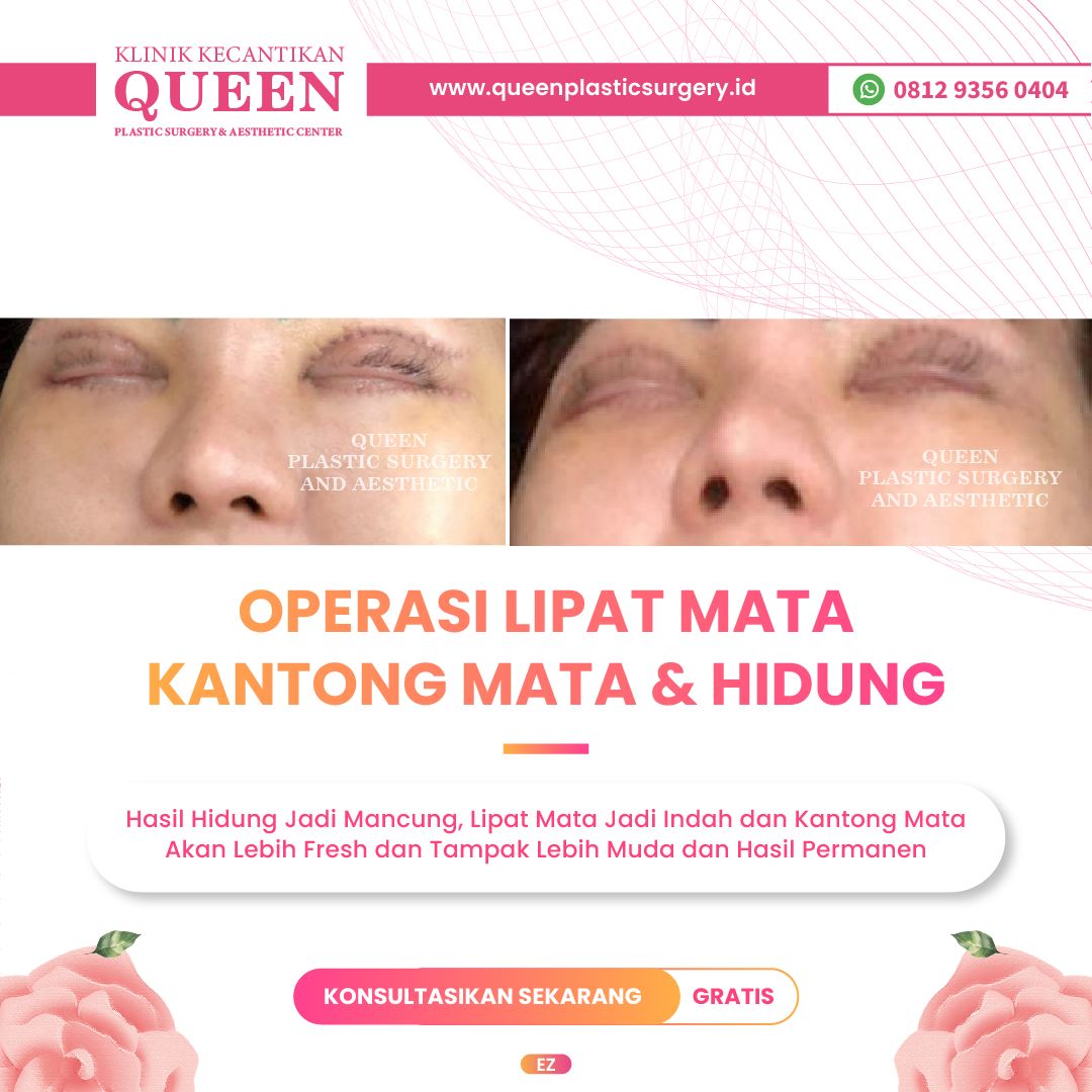 Feed12-05-fotor-20240401155916