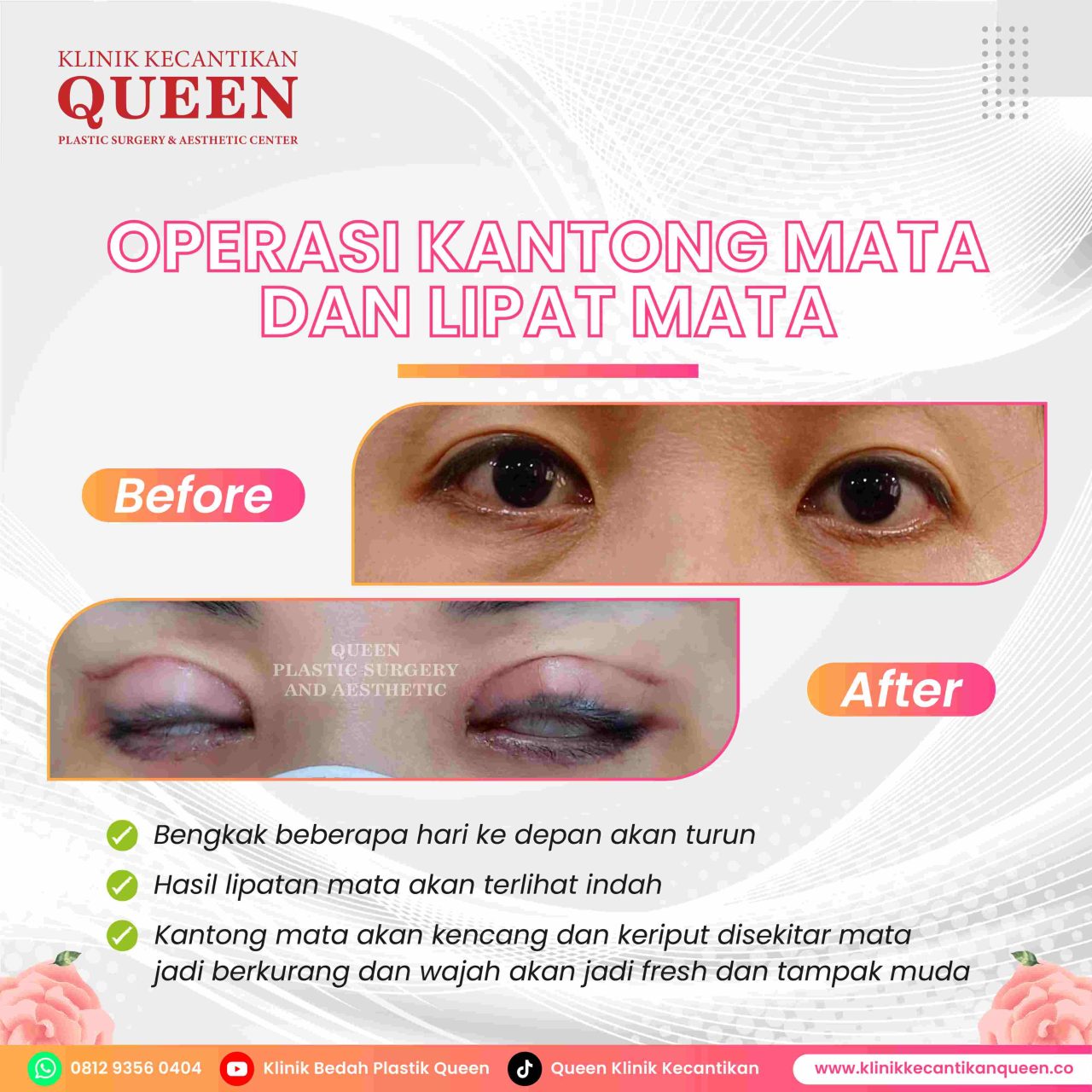 Feed15-03-fotor-20240629165150