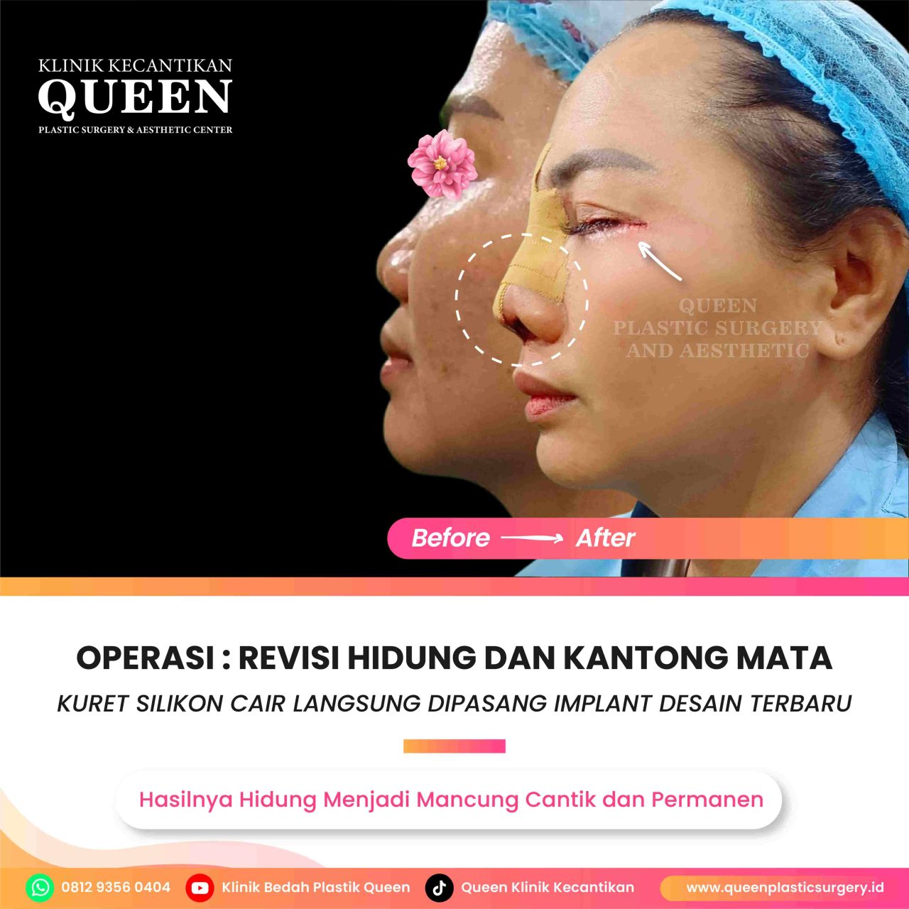 Feed18-06-fotor-2024062919323