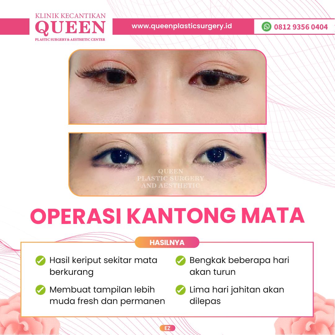 Feed3-09-fotor-2024040116042