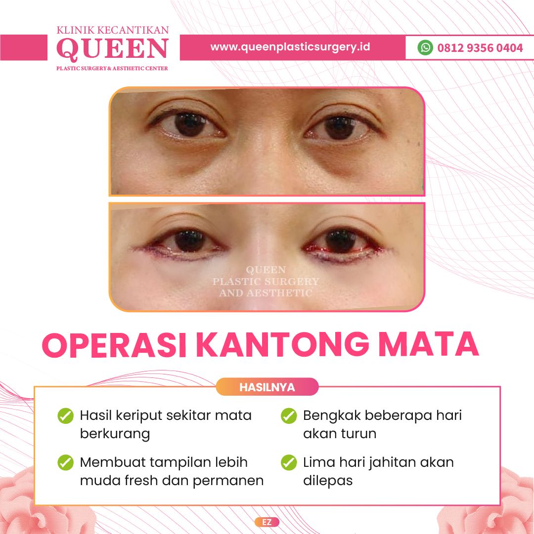 Feed3-10-fotor-2024040116225