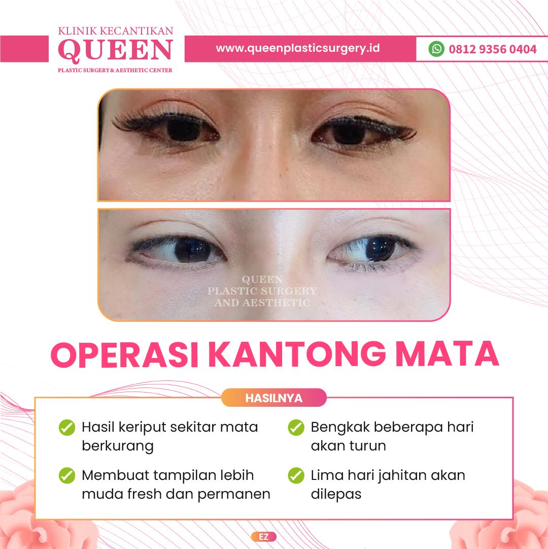 Feed3-11-fotor-2024040116155