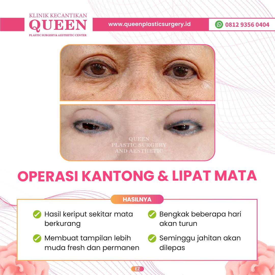 Feed3-12-fotor-20240401155848