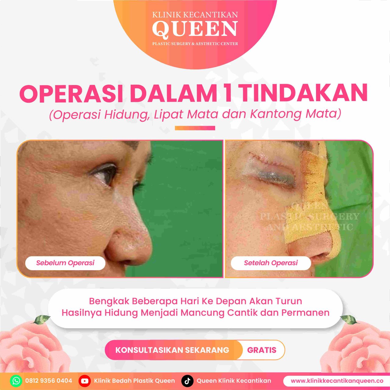 Feed4-06-fotor-202407025935