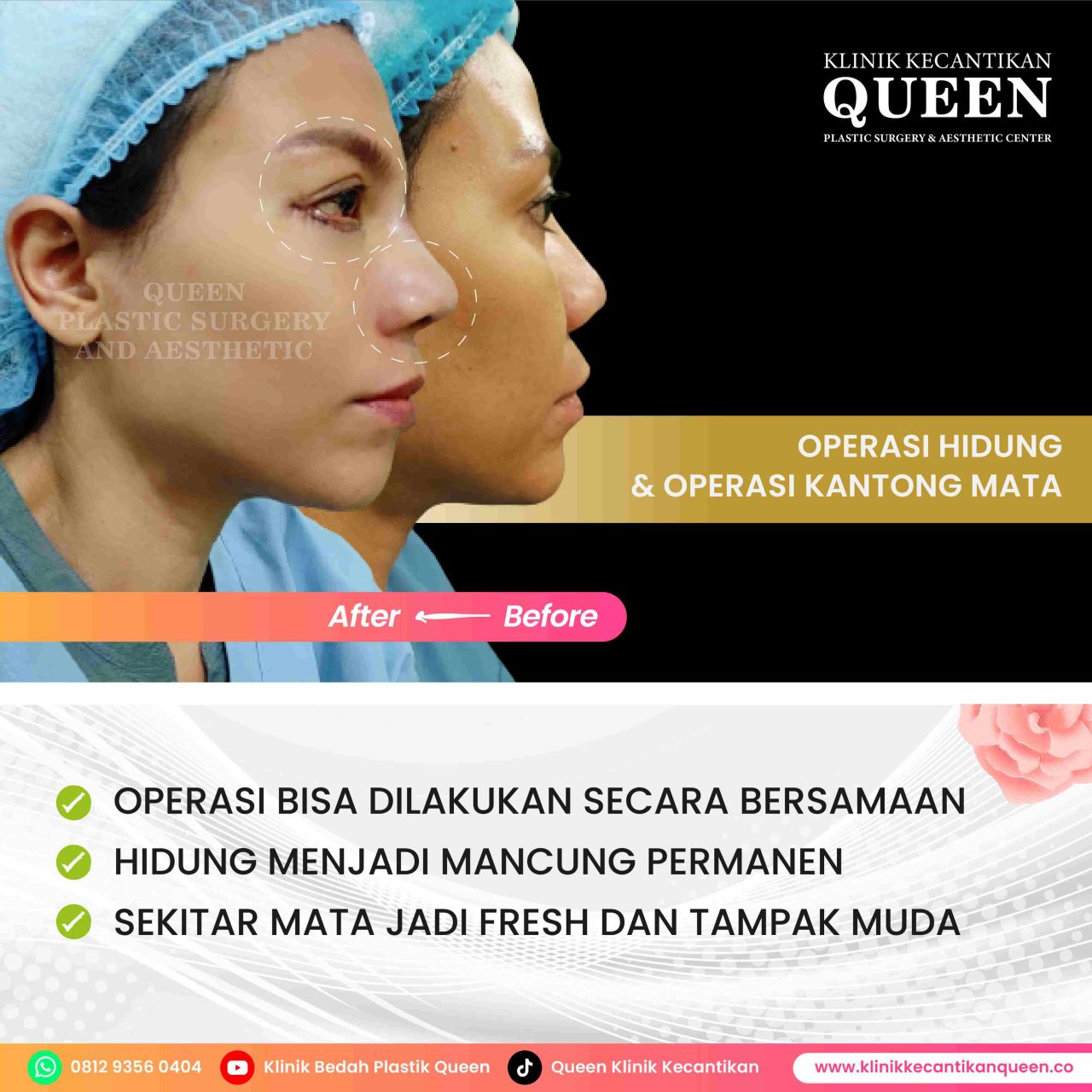 Feed6-07-fotor-2024062819823