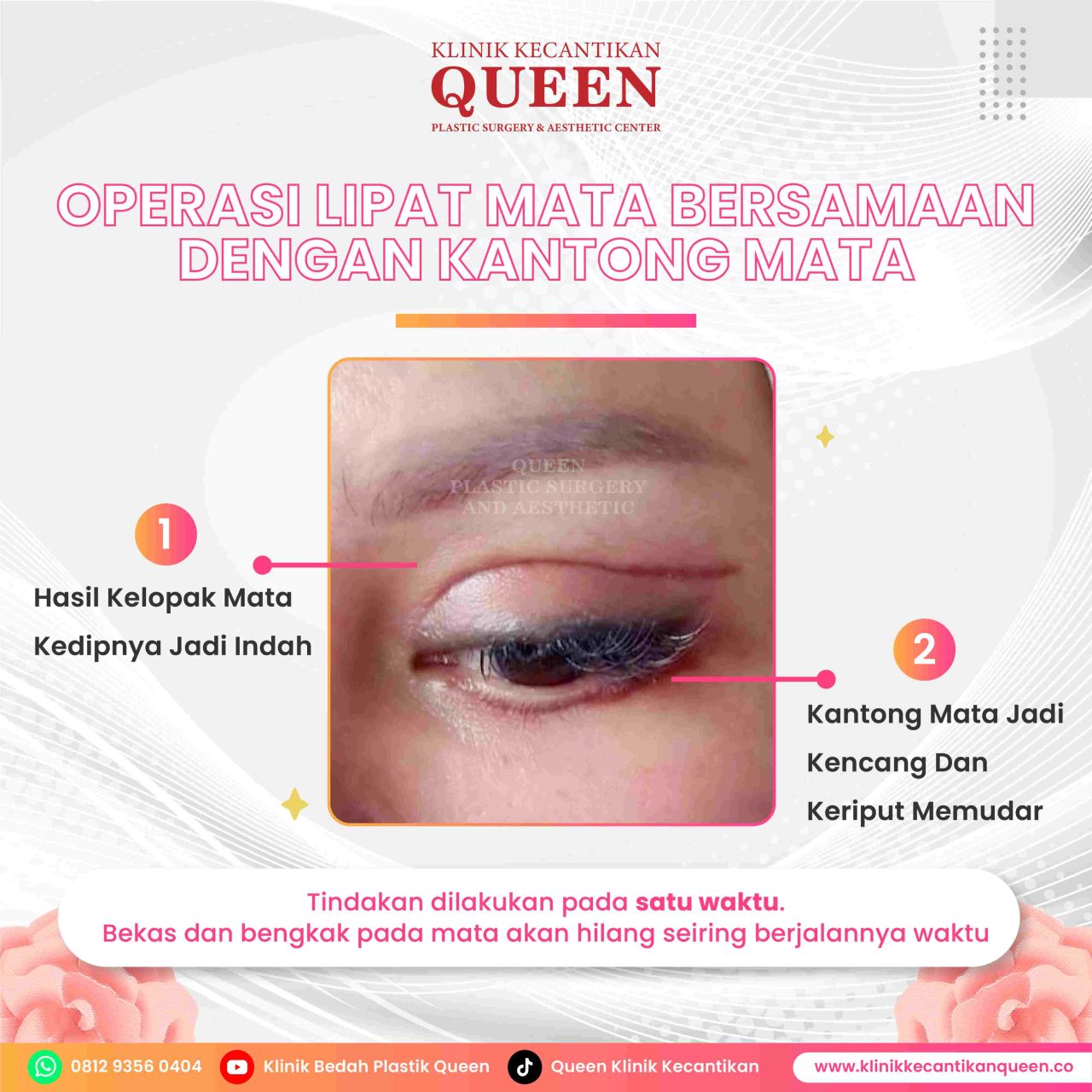 Feed8-06-fotor-20240629184455