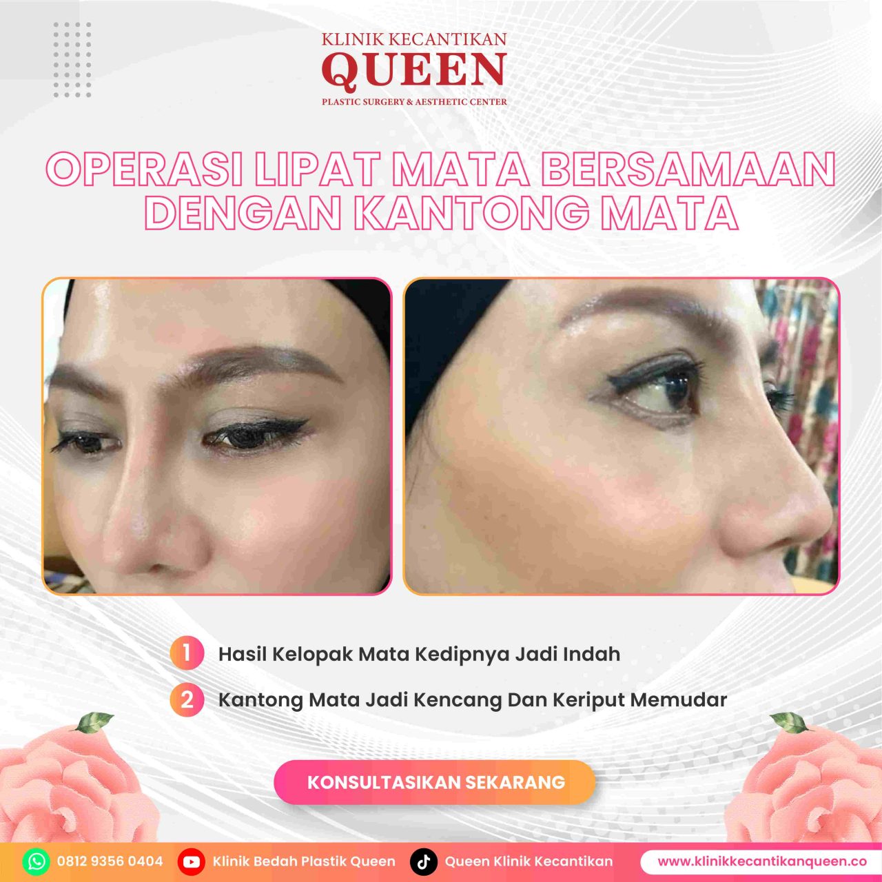 Alkohol dan Operasi Plastik: Bagaimana Kebiasaan Minum Anda Mempengaruhi Pemulihan?