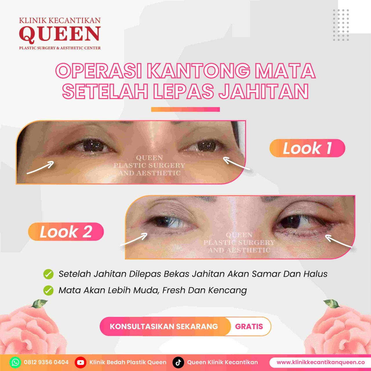 Feed9-02-fotor-20240702418