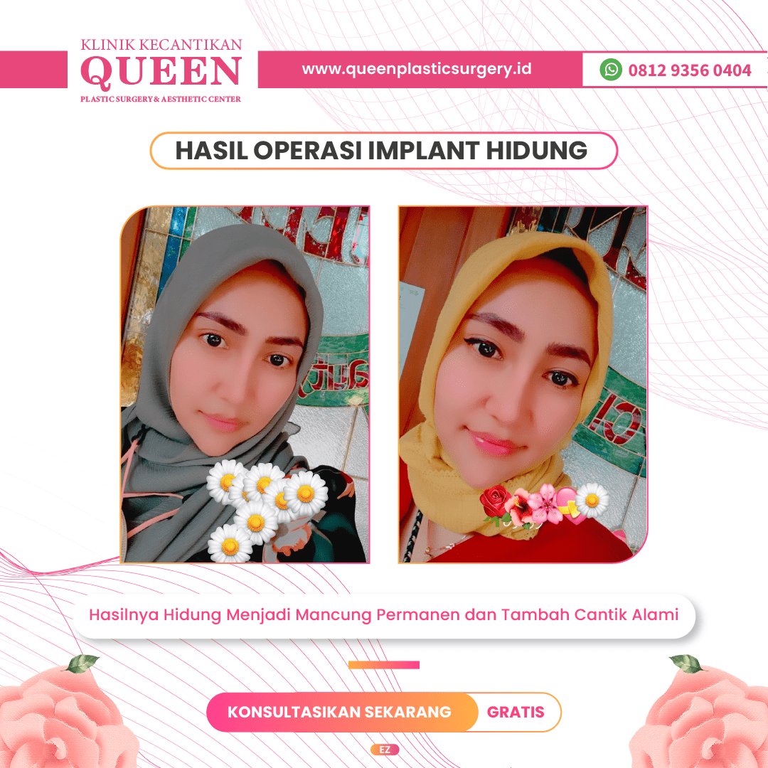 Feed9-04