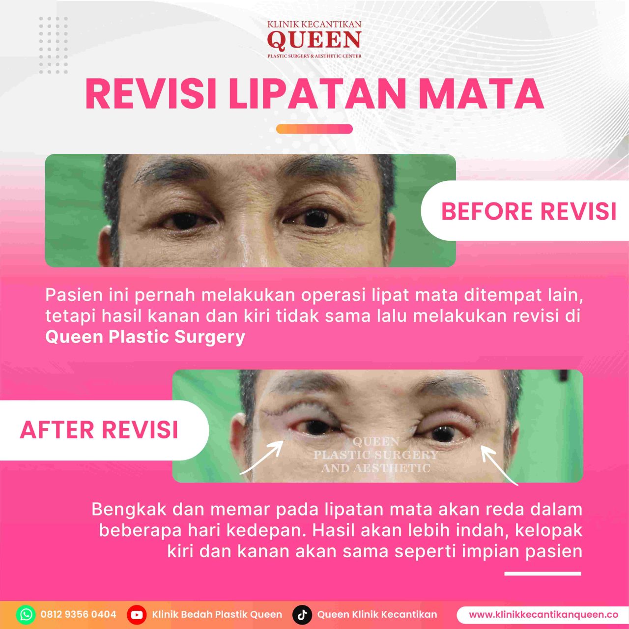 Feed9-05-fotor-20240628185129