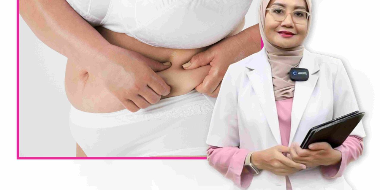 Tummy Tuck Tanpa Rasa Sakit Dengan Tanpa Drain