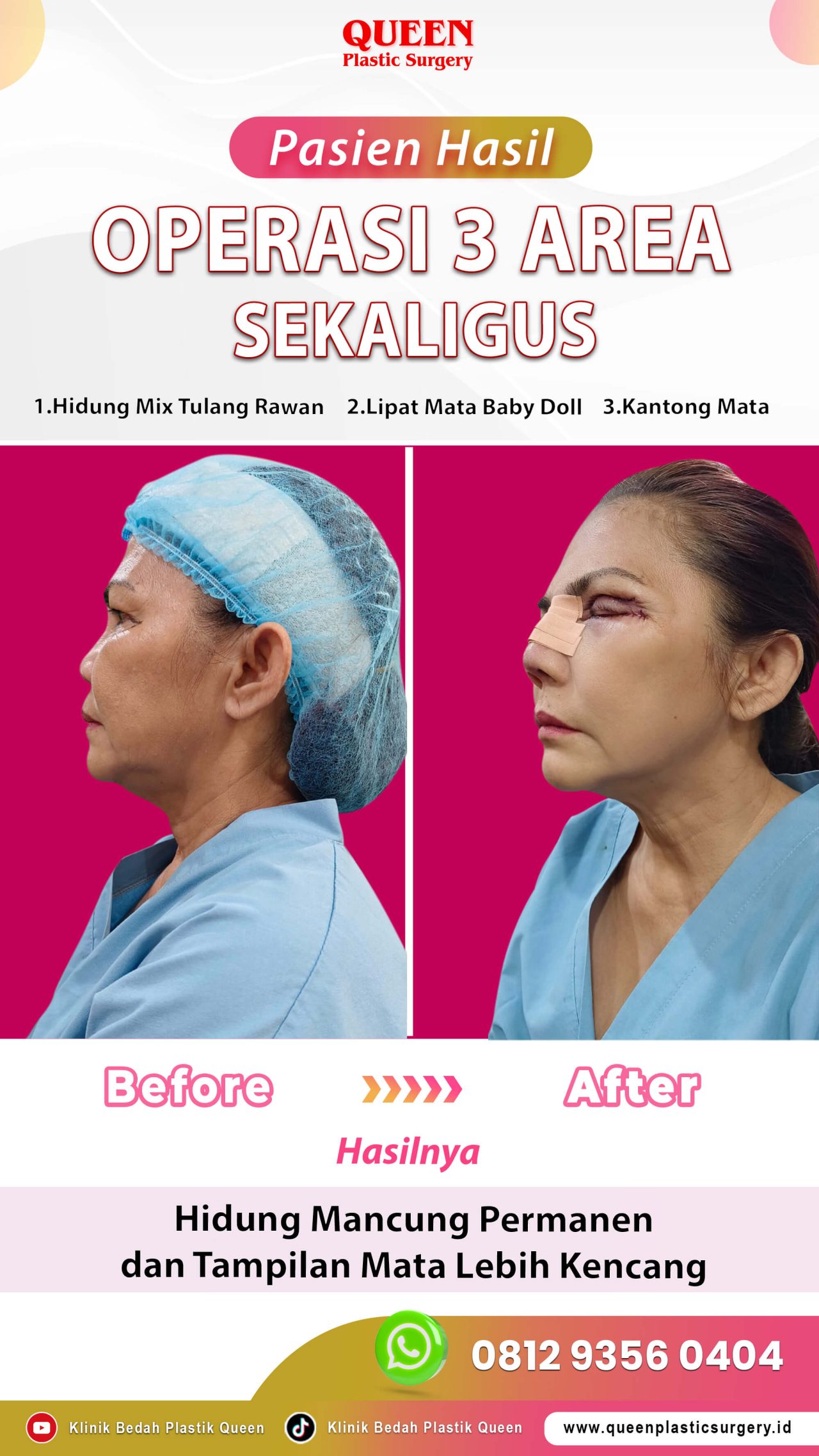 Operasi-3-Area-Sekaligus