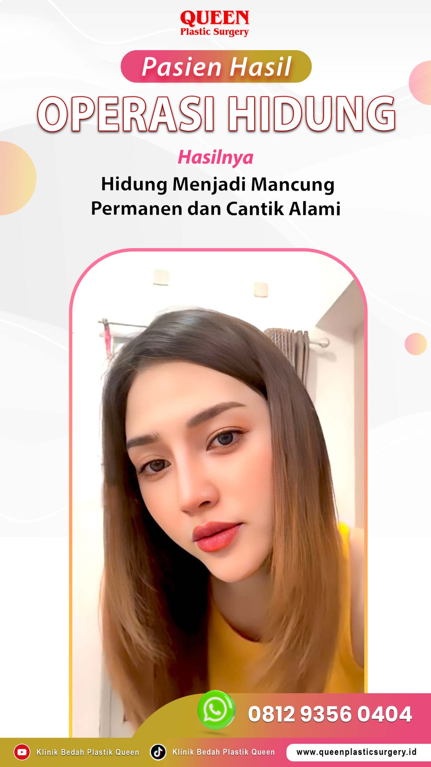 Operasi-Hidung-Pasien-IG-Story