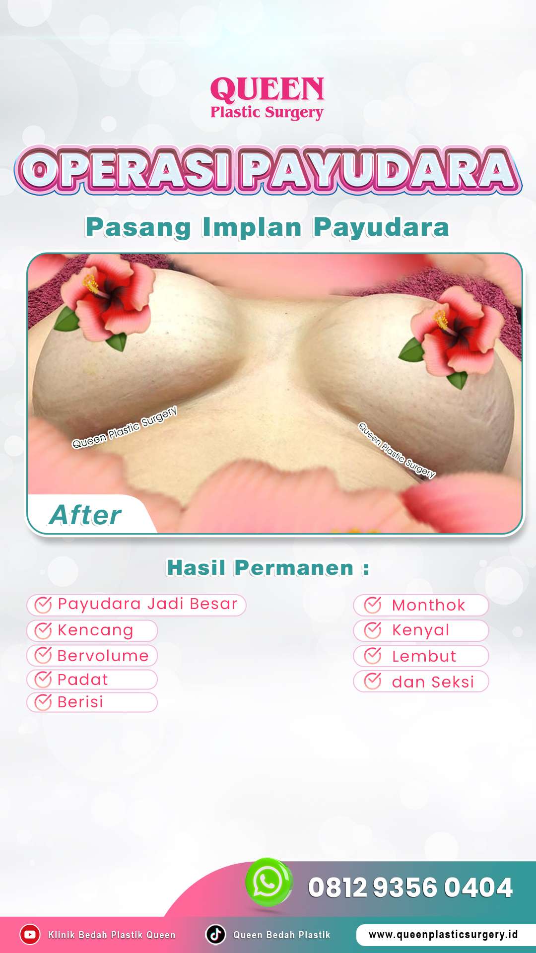 Pasien-After-Operasi-Payudara-Queen-009-