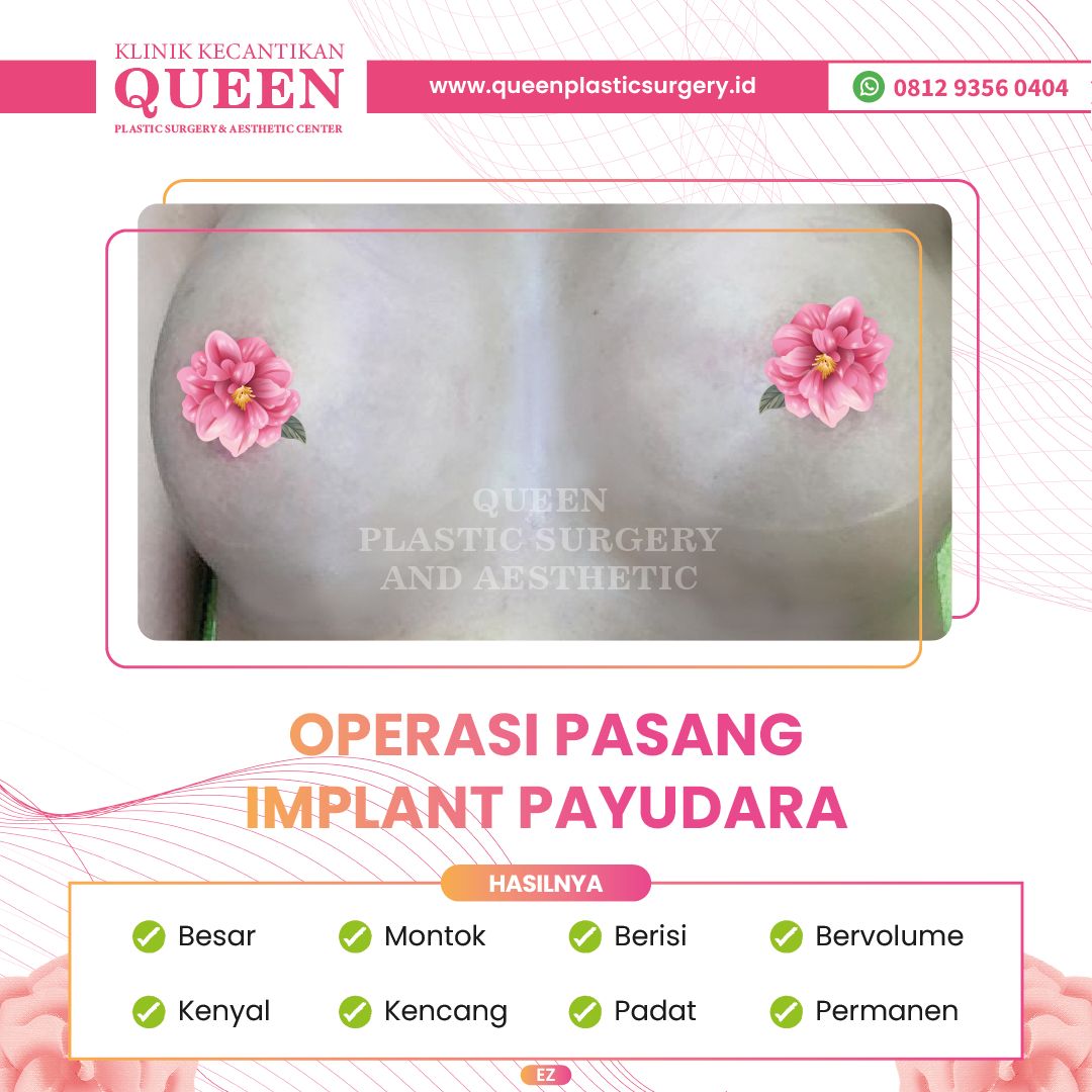 Payudara-01-fotor-20240401154827
