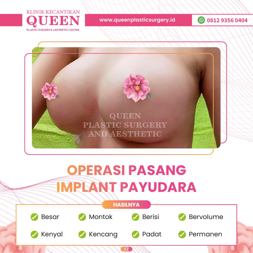 Payudara2-05-fotor-20240401154456