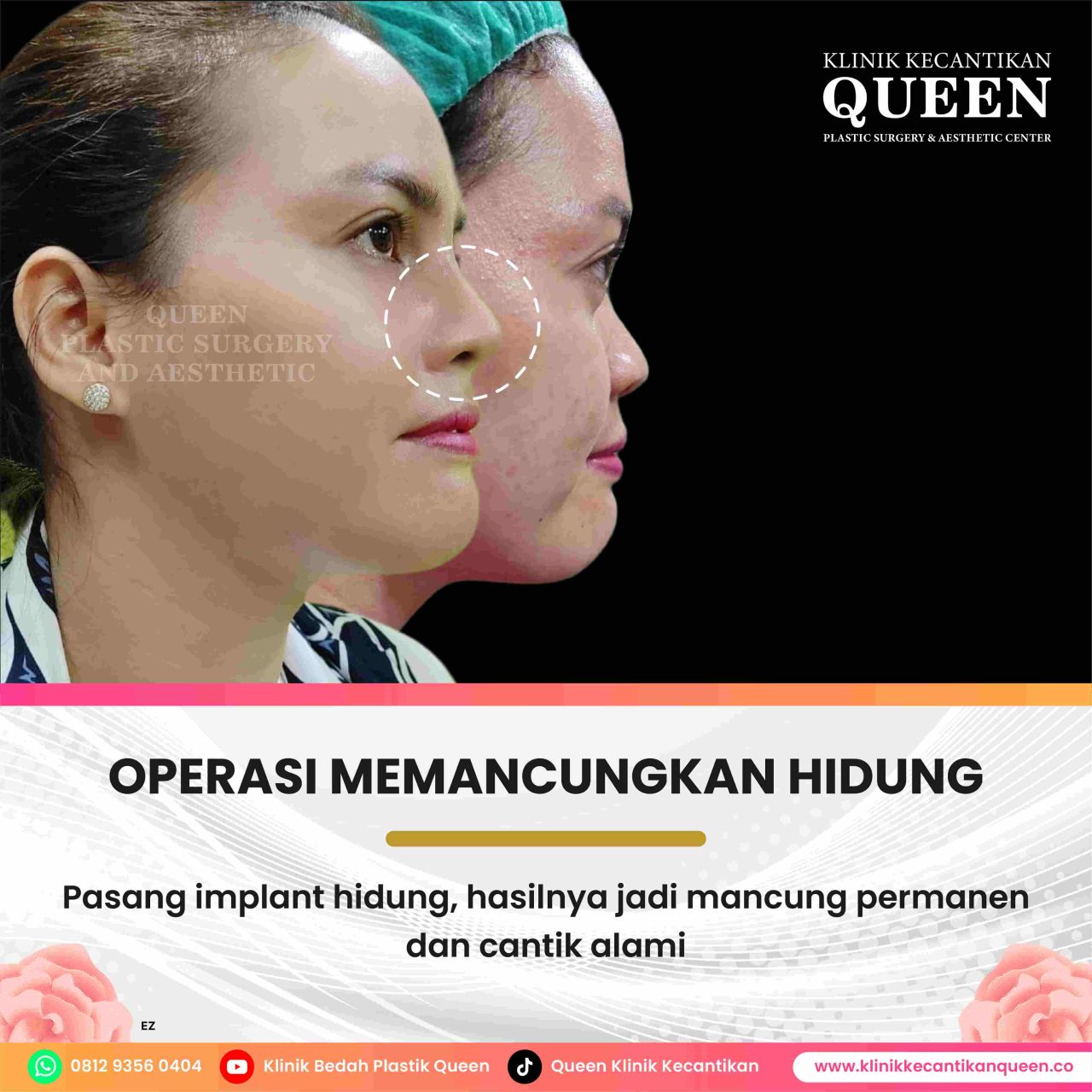 Perawat1-01-fotor-20240629172158