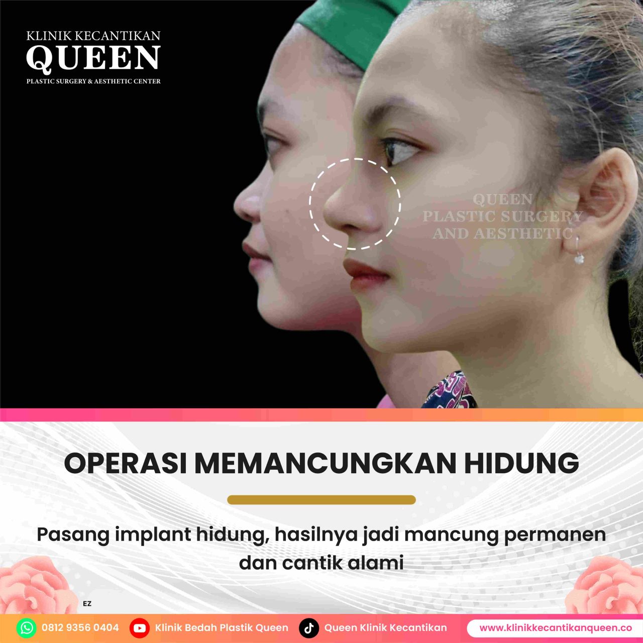 Perawat2-02-fotor-2024062918154