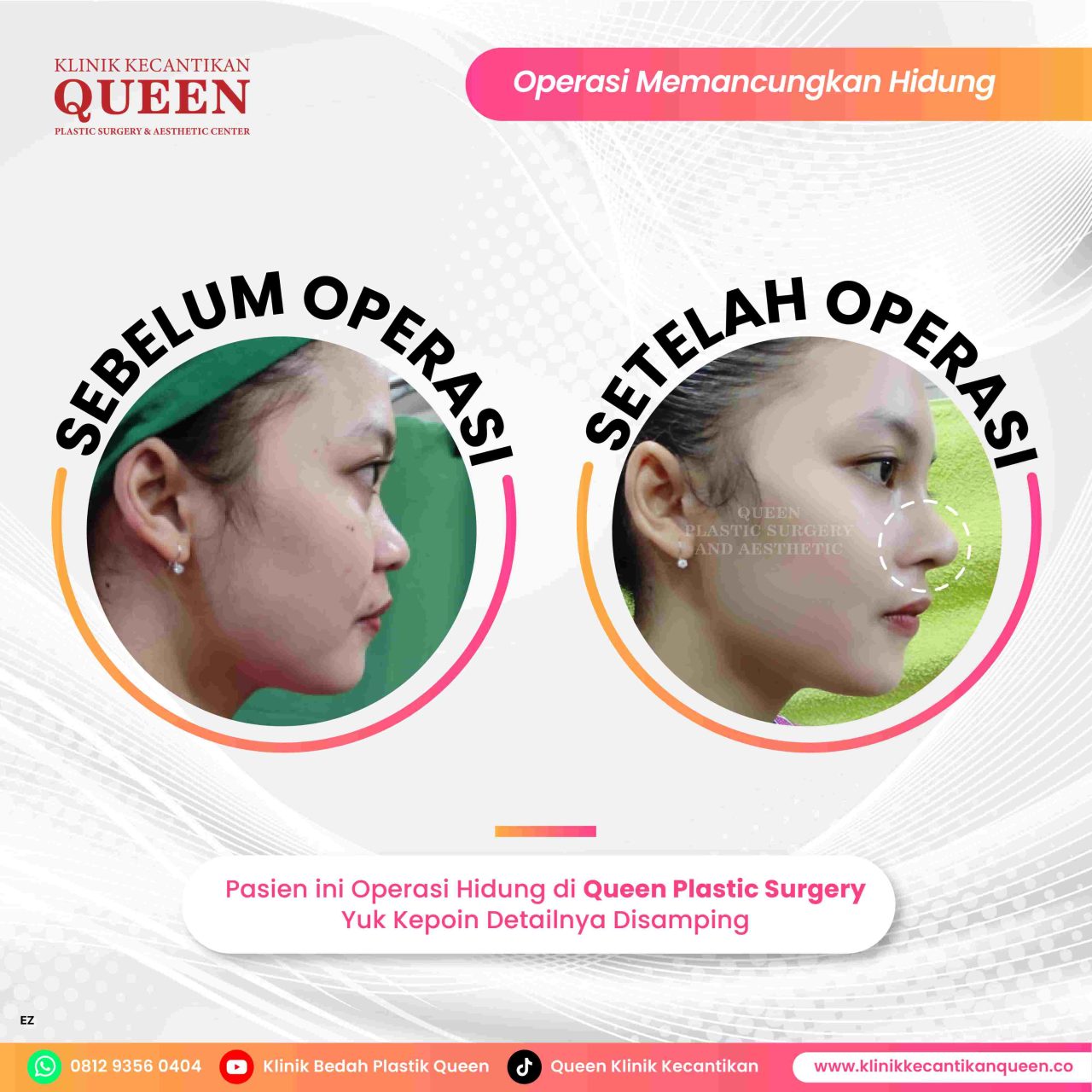 Perawat2-04-fotor-20240629181443