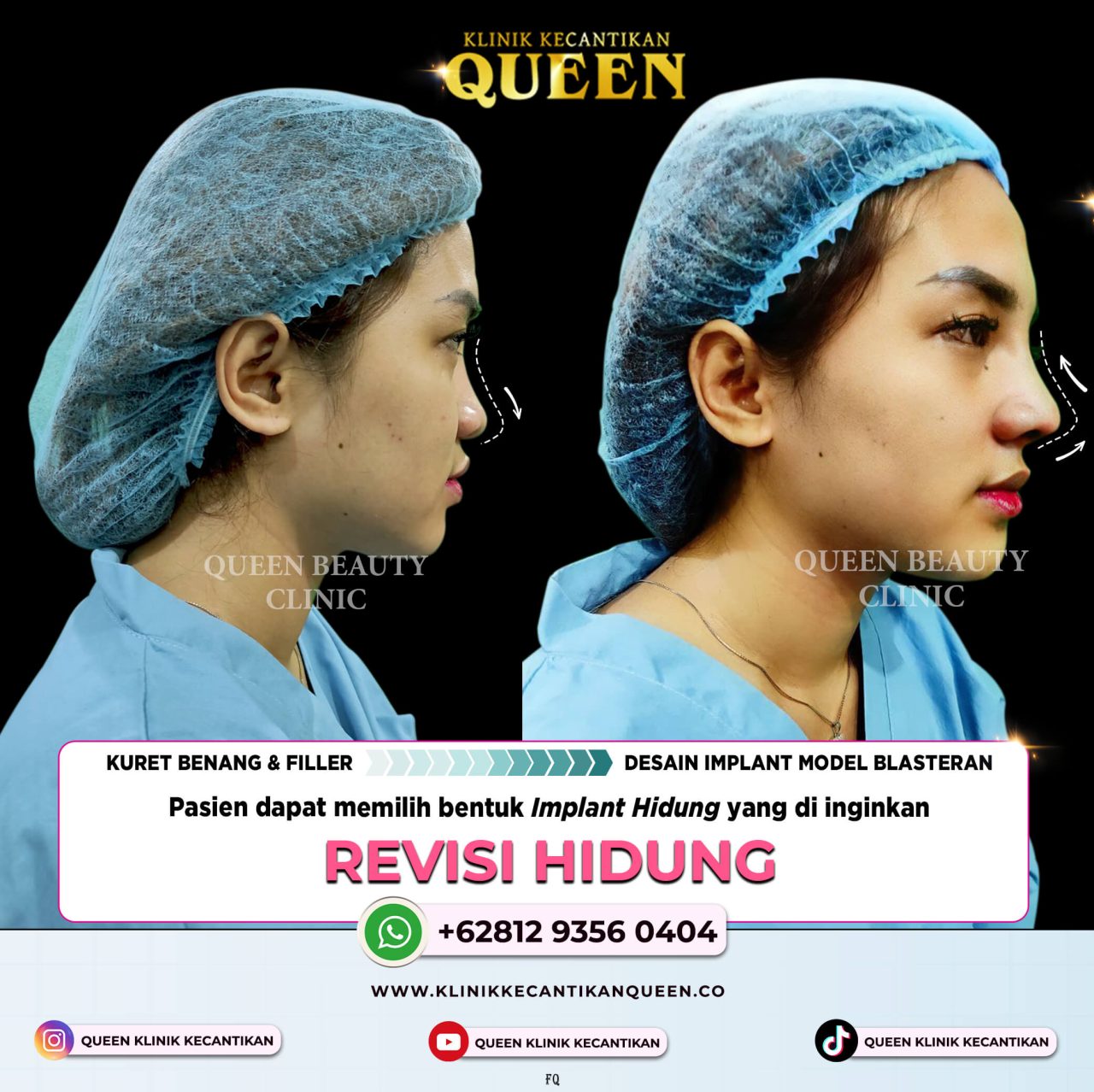 REVISI HIDUNG 2 (2)
