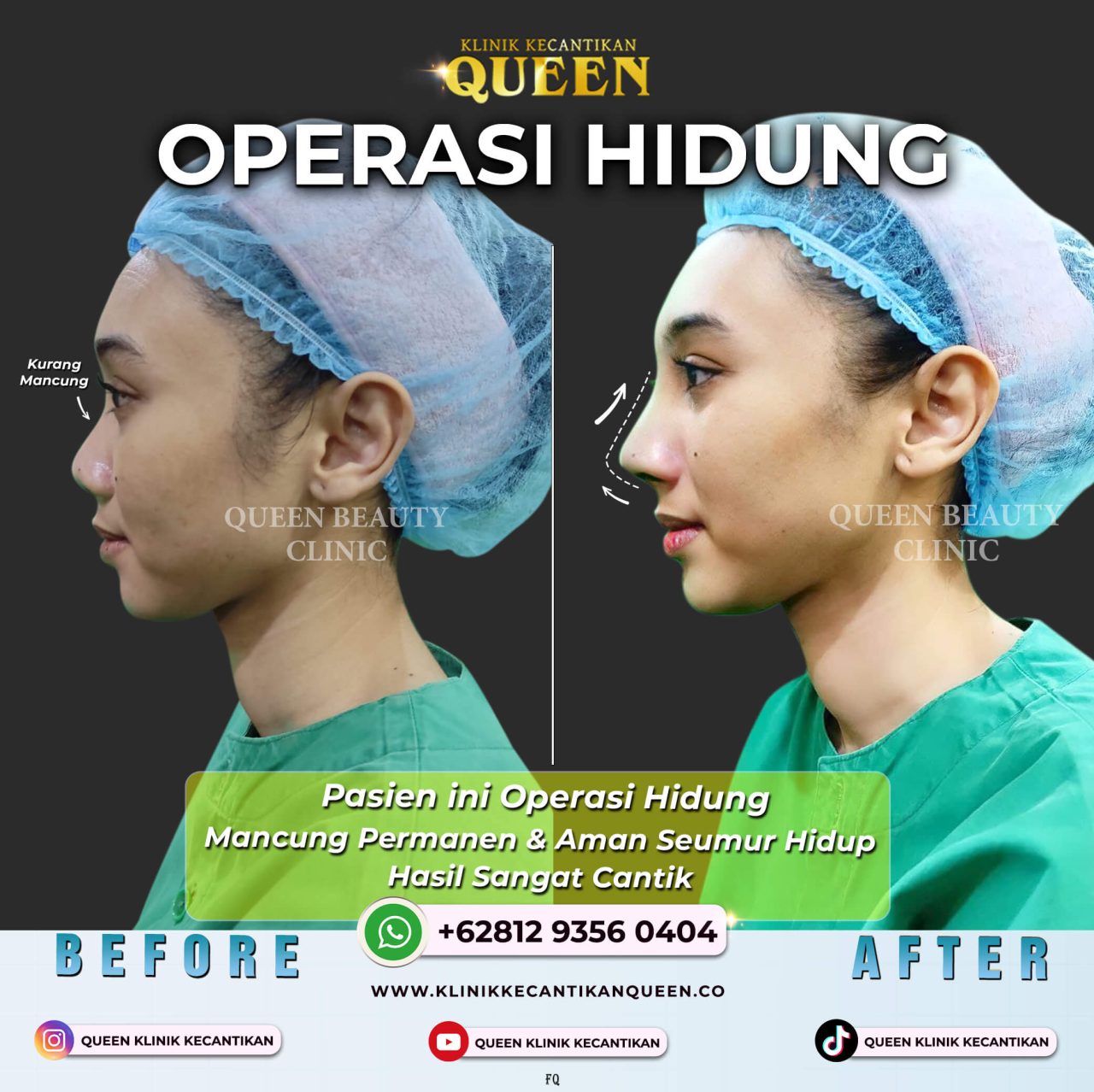 REVISI HIDUNG BEBAS SENSOR 02