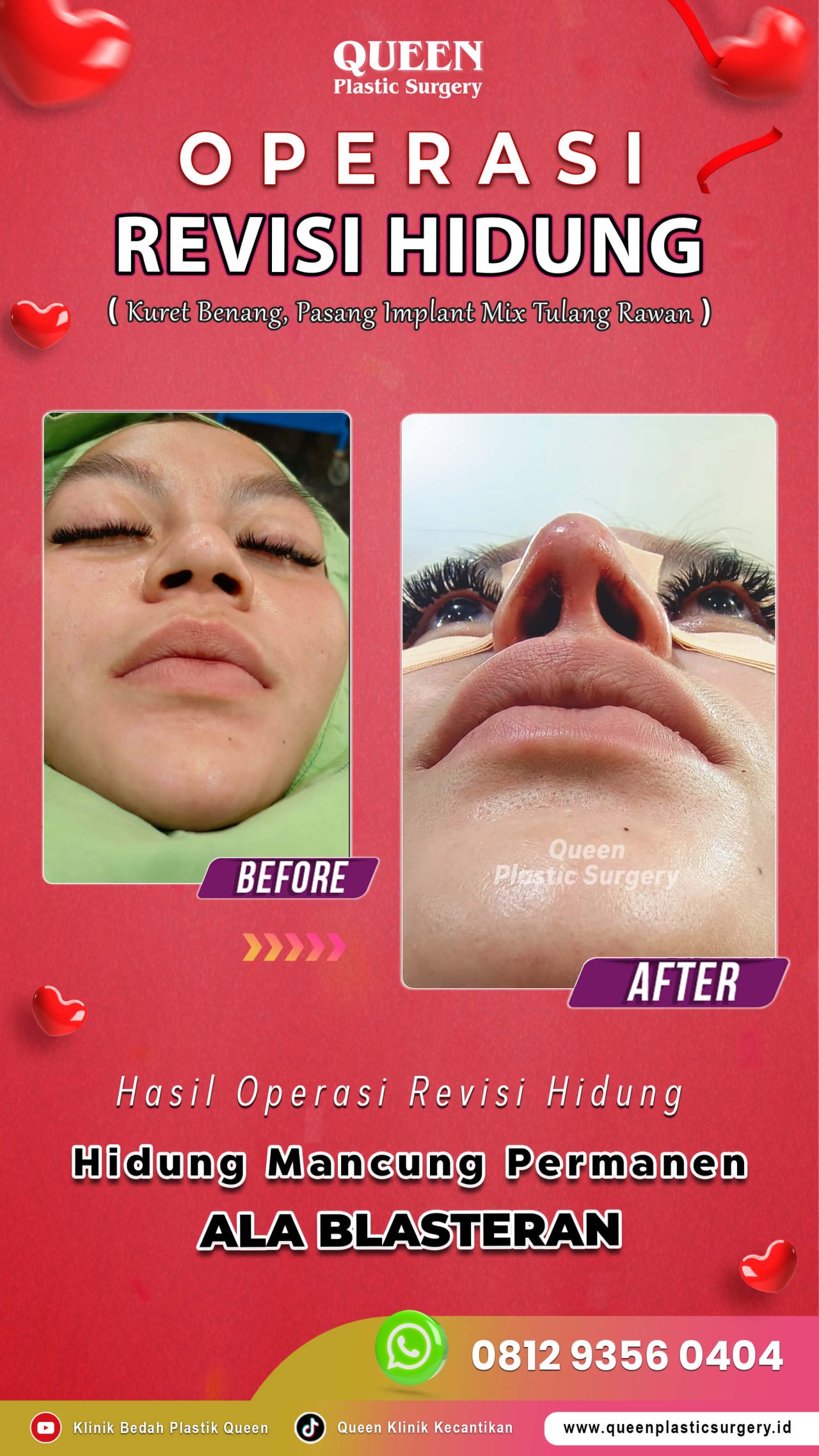 Revisi-Hidung-03 (2)
