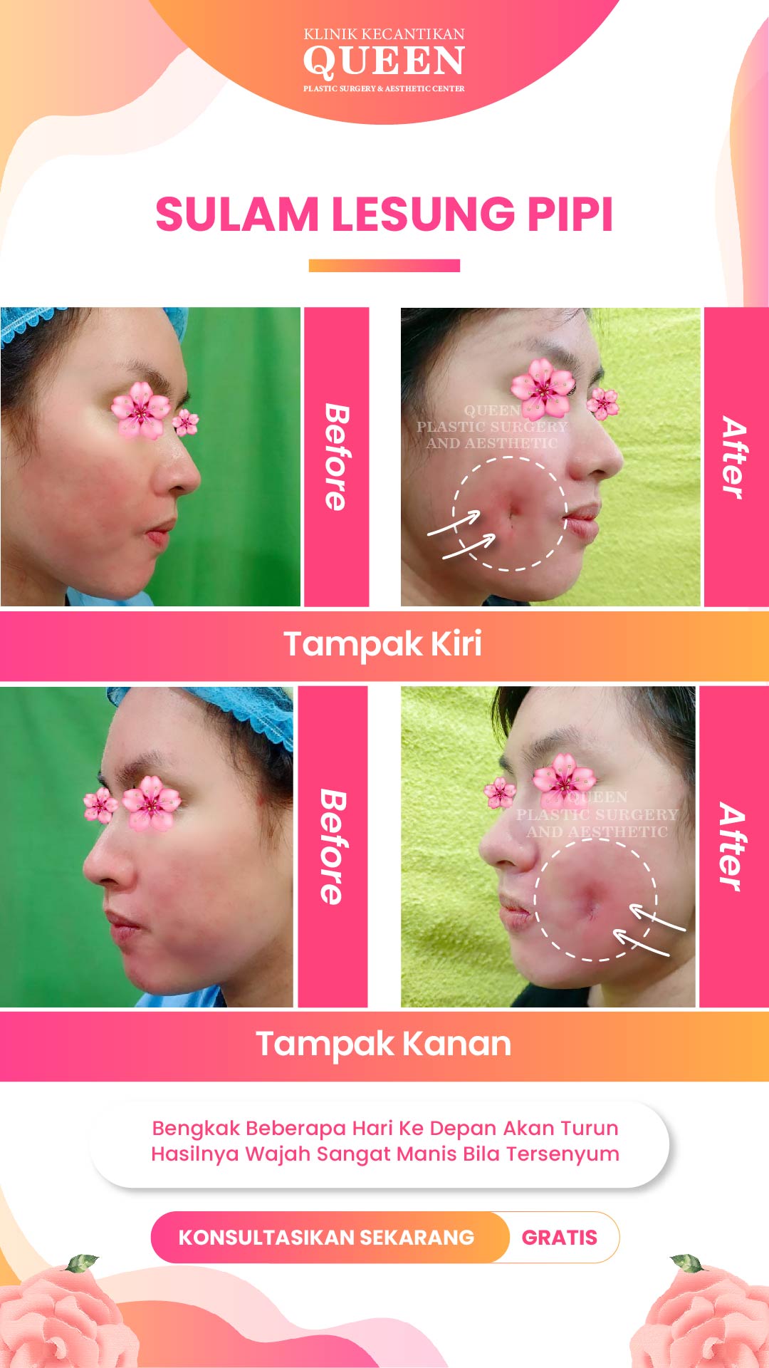 Story10-04 Story10-04