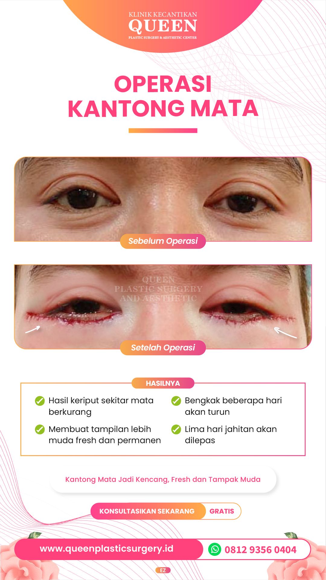 Story11-01-fotor-20240401163917