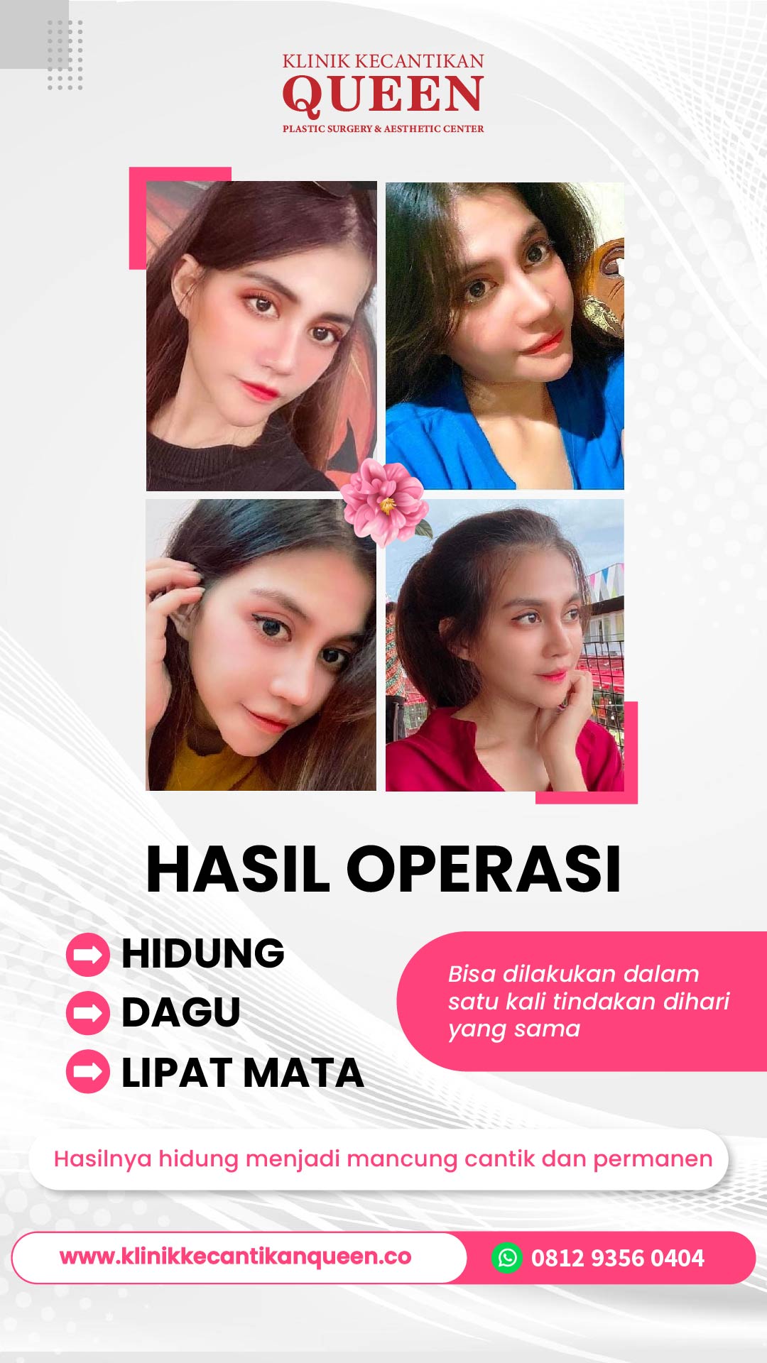 Story11-02