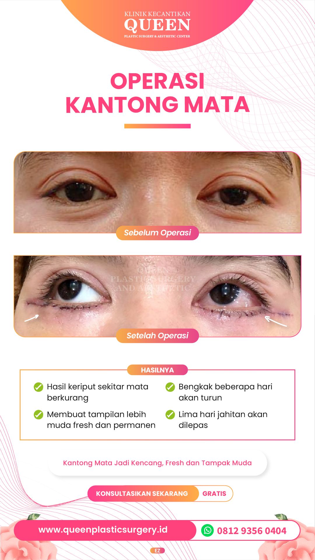 Story11-02-fotor-20240401163432