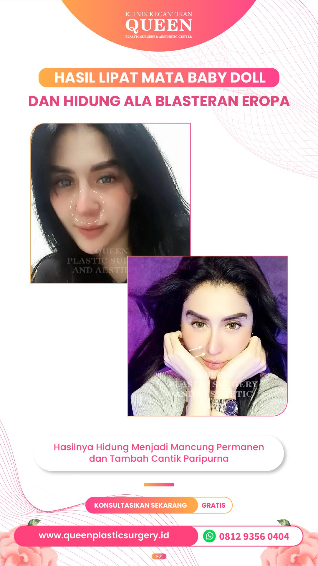 Story11-03-fotor-20240401164133