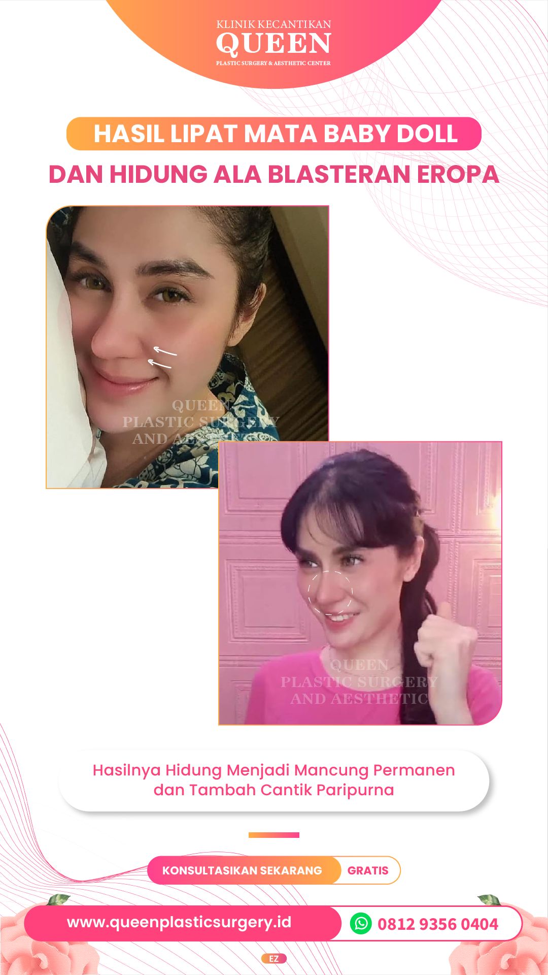 Story11-04-fotor-2024040116395