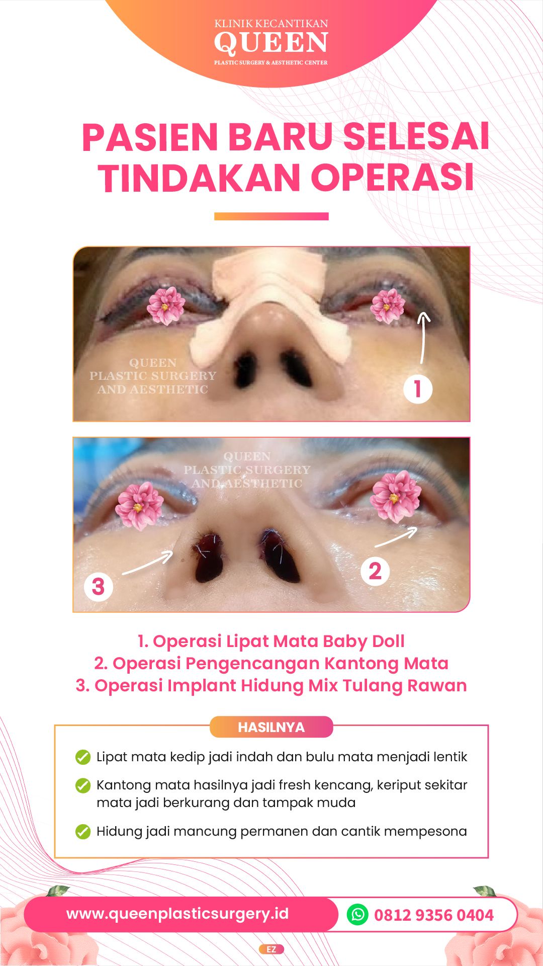 Story3-01-fotor-2024040116402