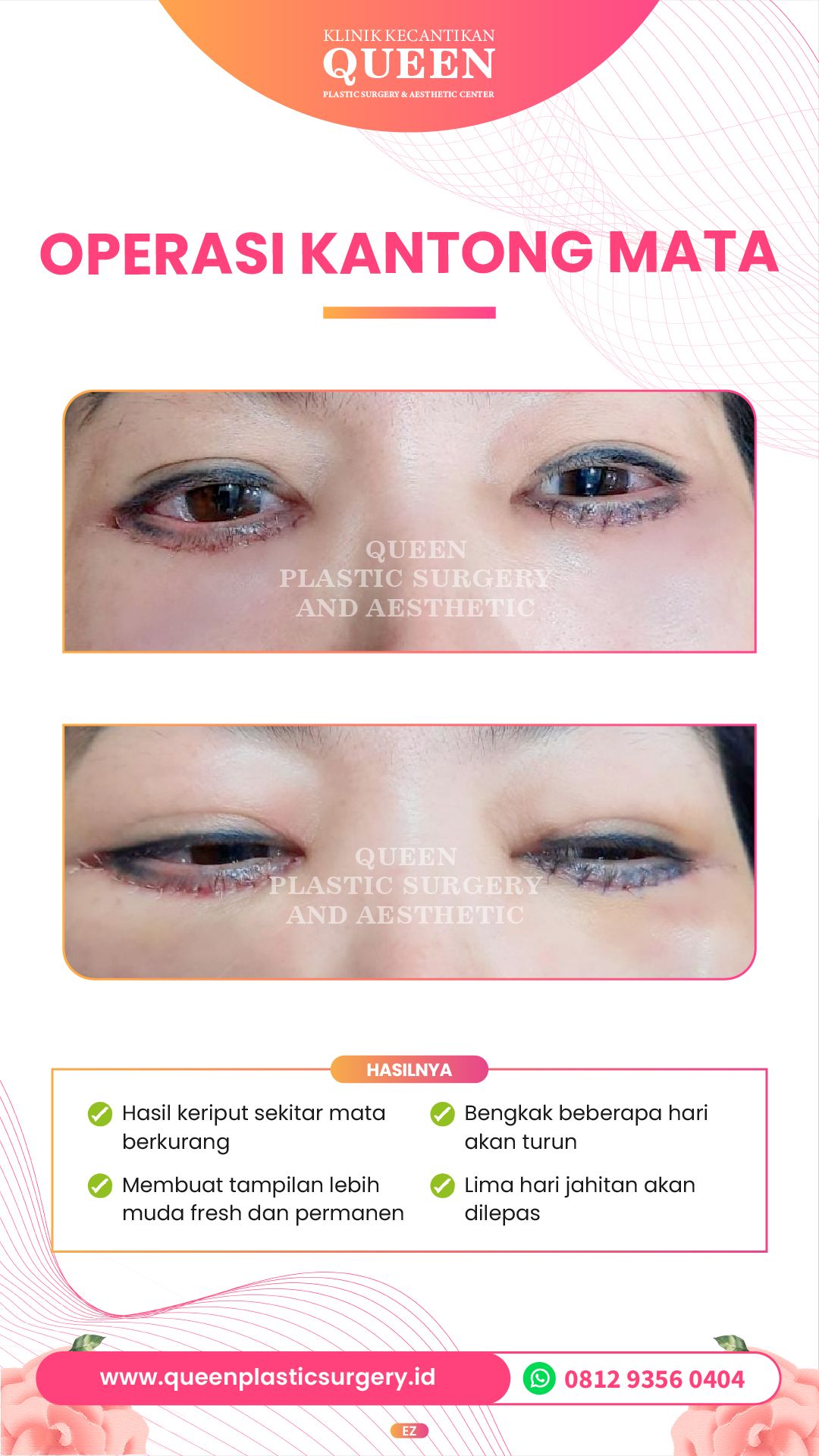 Story3-03-fotor-20240401164125