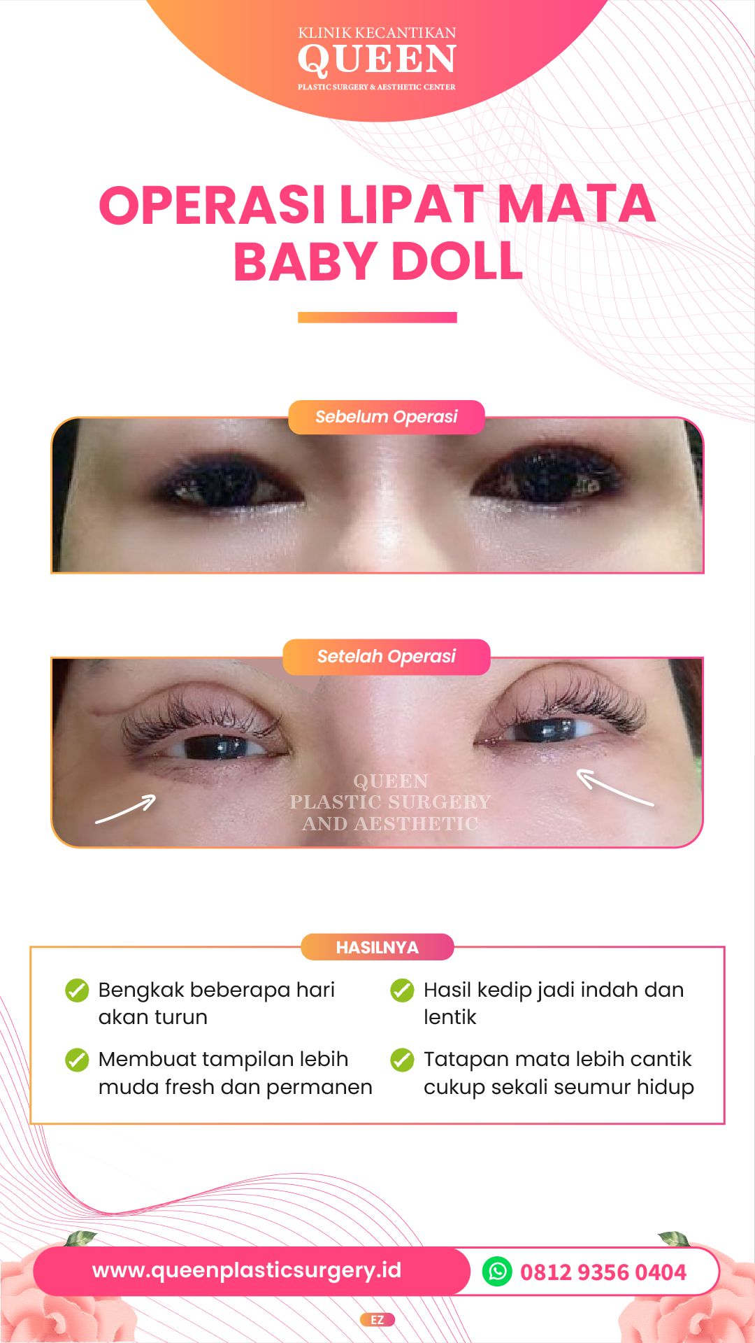 Story3-04-fotor-20240401163856