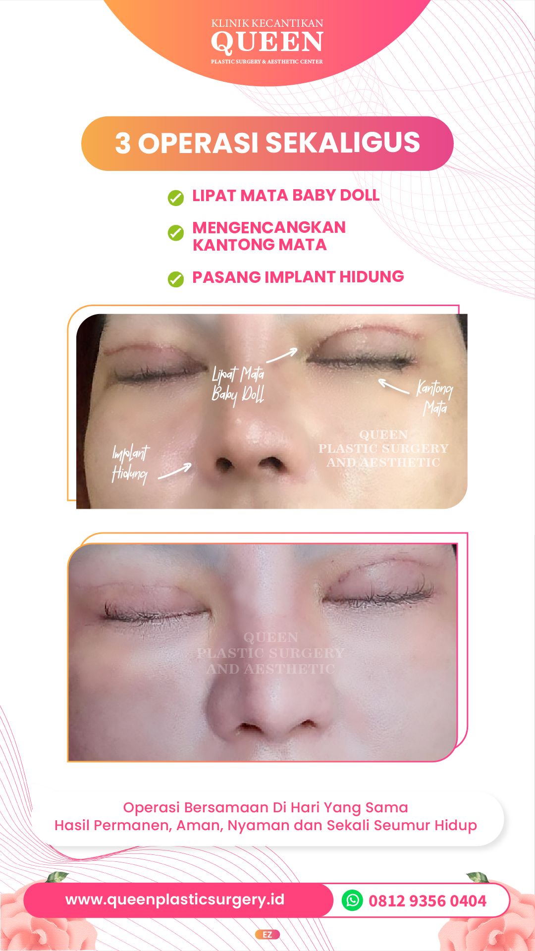 Story3-05-fotor-2024040116415