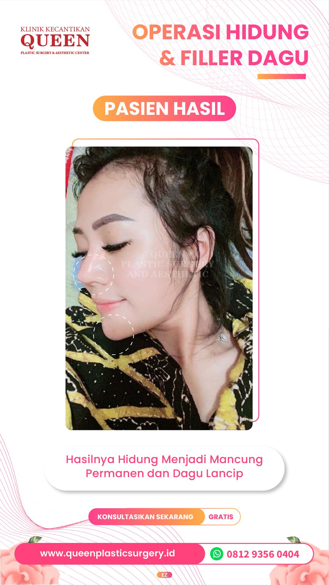 Story3-09-fotor-2024040116376