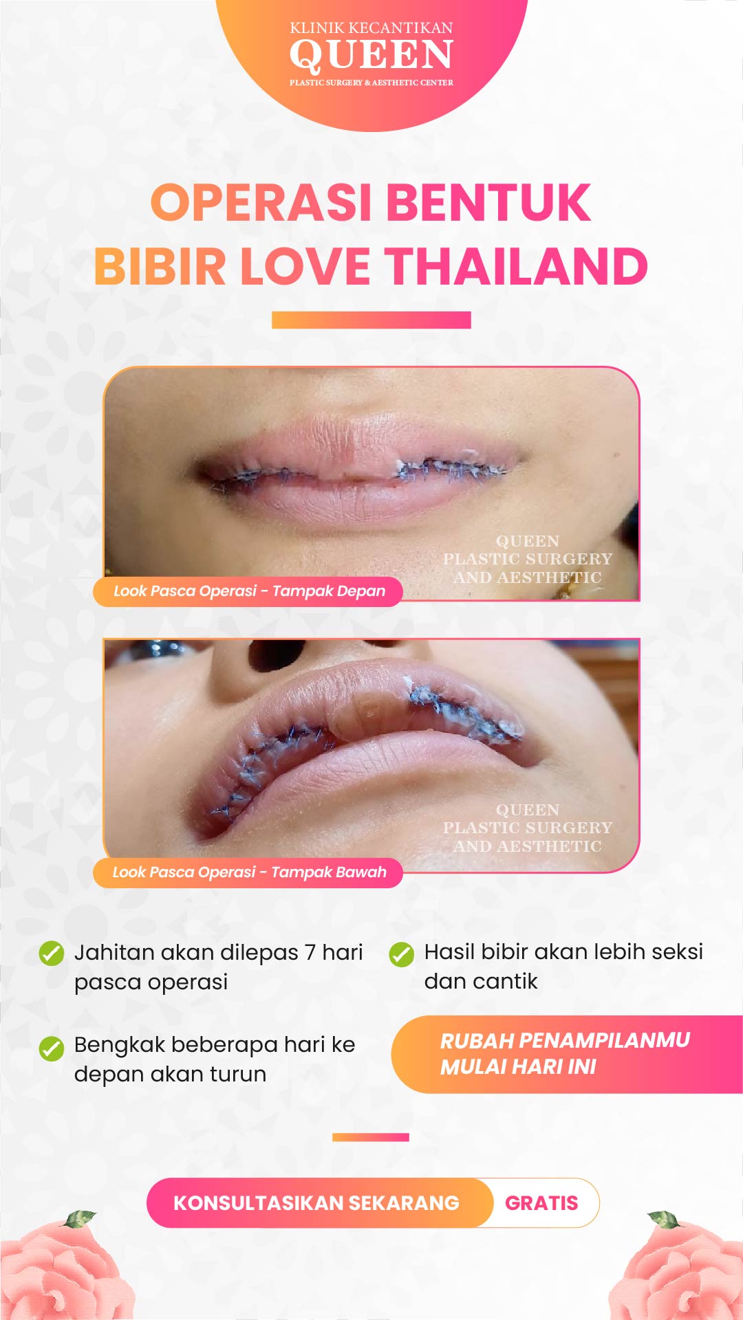 Story5-04 Story5-04