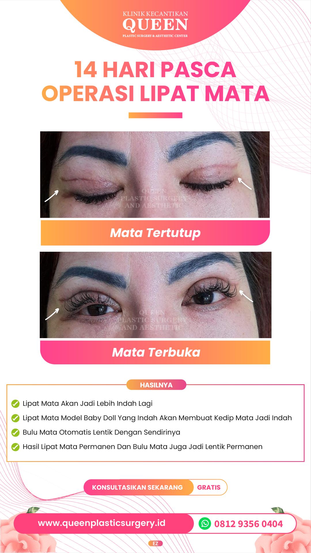 Story5-05-fotor-2024040116529