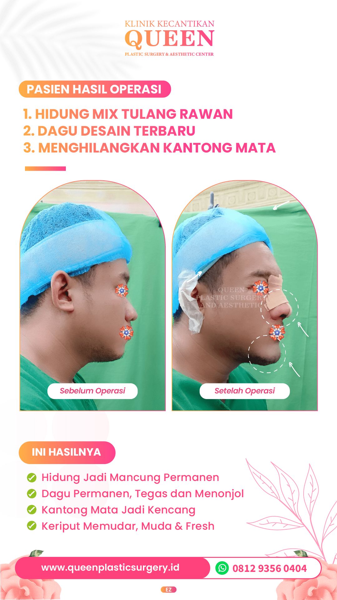 Story7-07-fotor-2024040314149