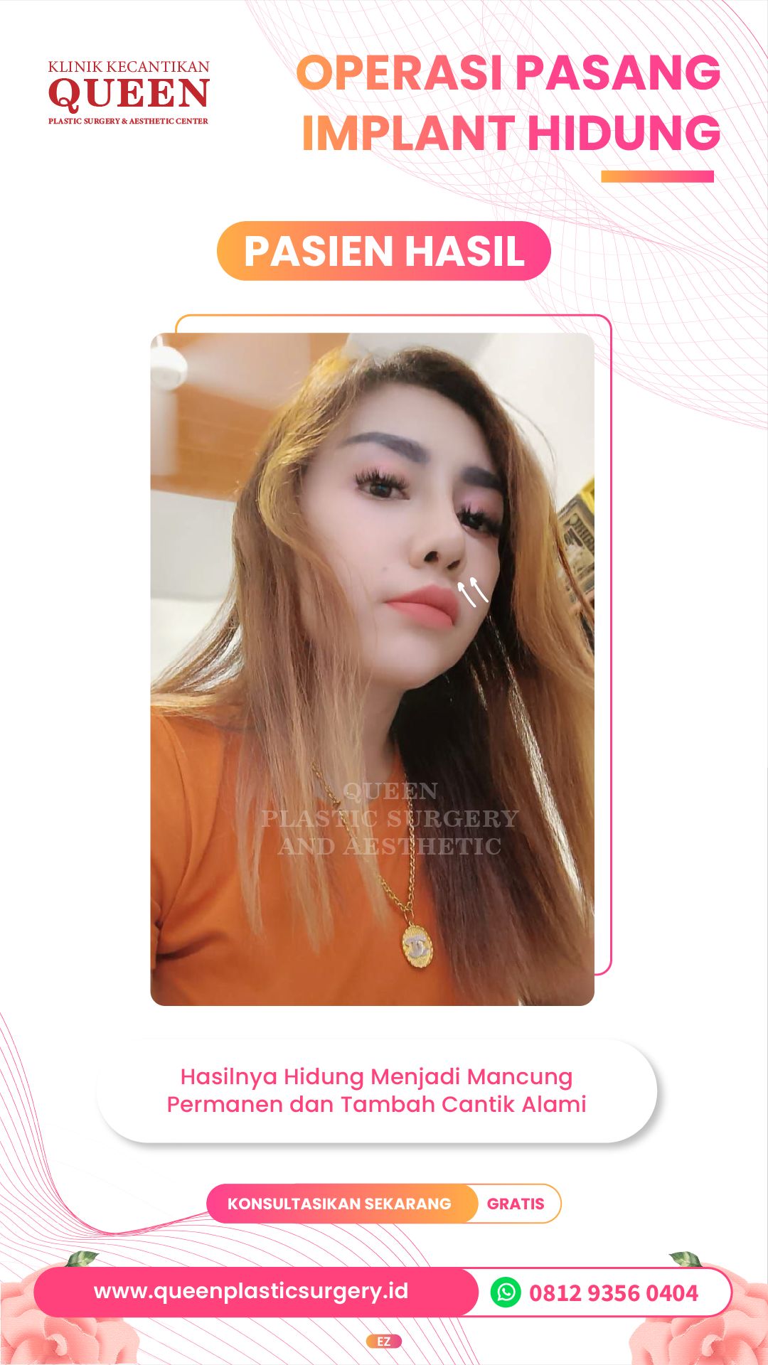 Story8-03-fotor-20240401165317