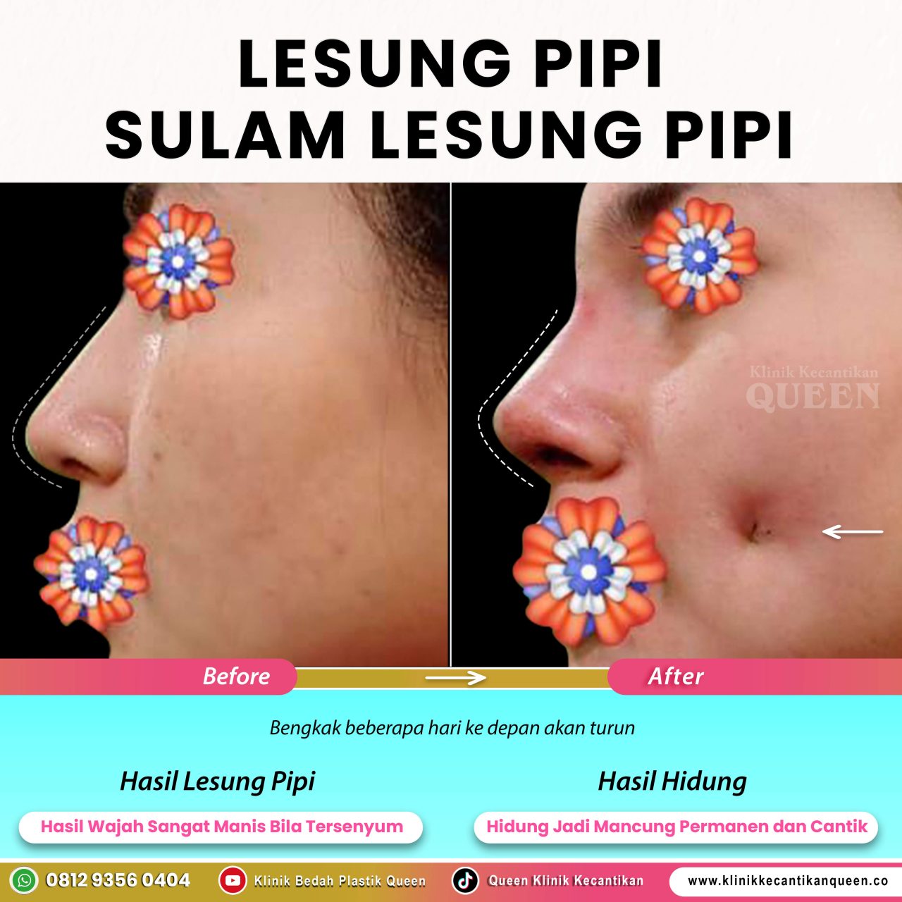 Sulam-Lesung-Pipi-03 Sulam-Lesung-Pipi-03