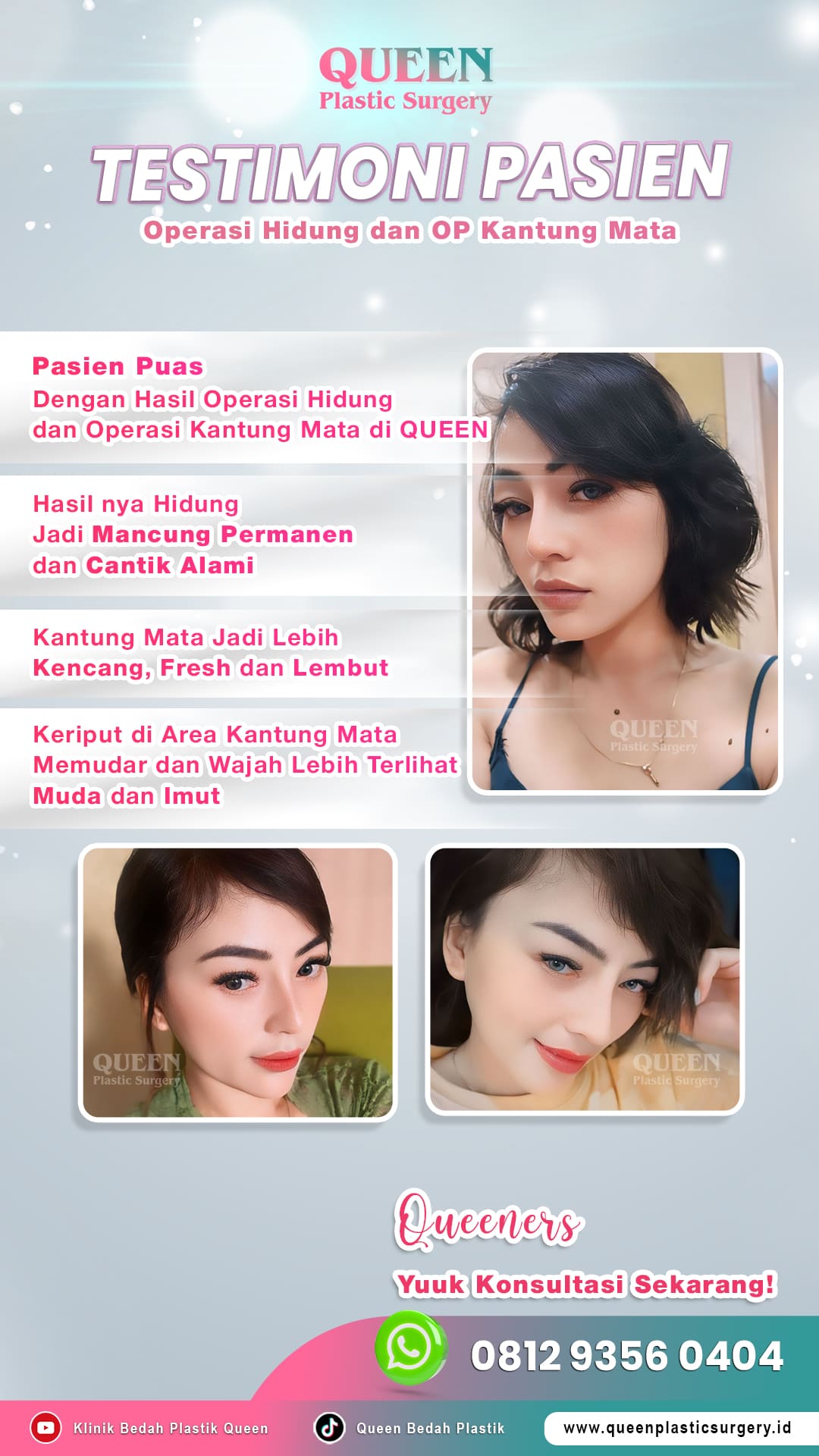 Testimoni-Pasien-OP-Hidung-dan-OP-Kantung-Mata